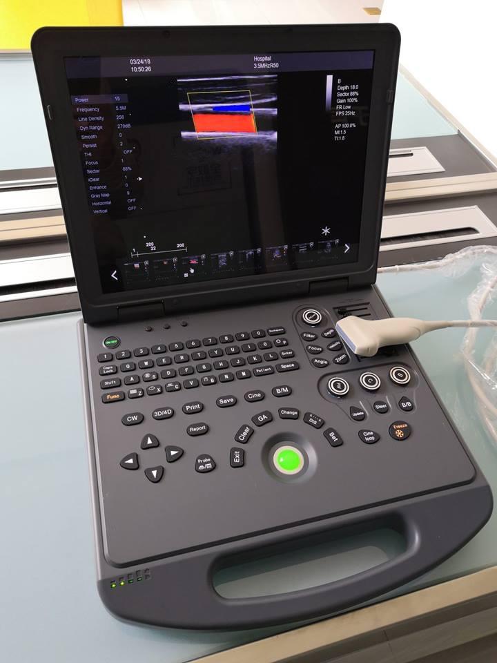 YJ-C60  3D 4D Portable Color Doppler Ultrasound Scanner 