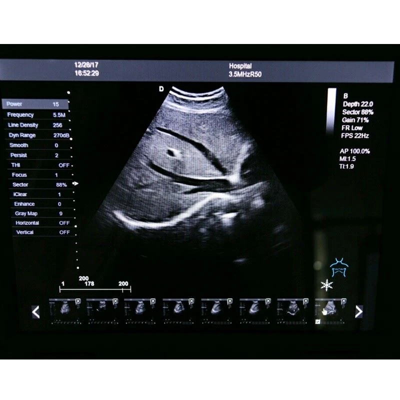 Ultrasound Machine (2)