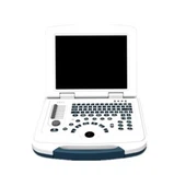 B/W σύστημα διάγνωσης υπερήχων σημειωματάριων