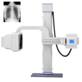 Ψηφιακή ακτίνα Χ υψηλής συχνότητας