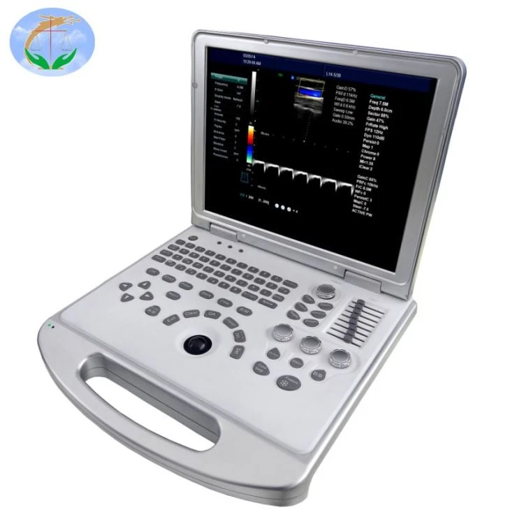Portable Ultrasound Scanner Portable Ultrasound Scanner